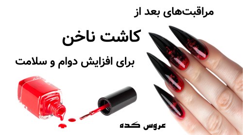 مراقبت‌های بعد از کاشت ناخن برای افزایش دوام و سلامت