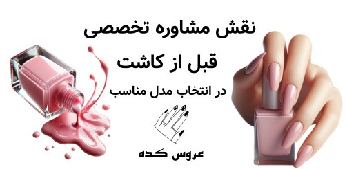 نقش مشاوره تخصصی قبل از کاشت در انتخاب مدل مناسب