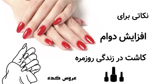 نکاتی برای افزایش دوام کاشت در زندگی روزمره