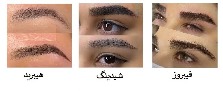 تفاوت فیبروز، پودری و هیبرید
