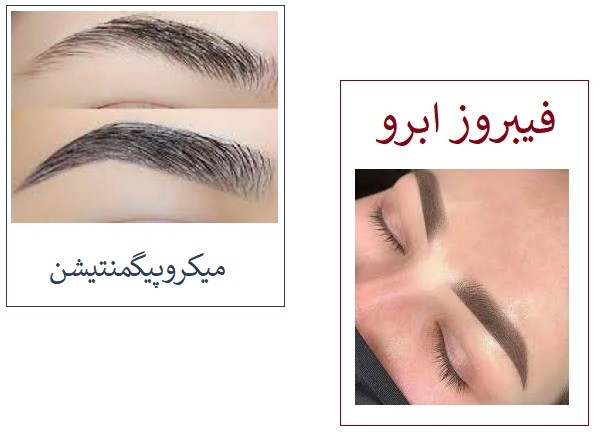 فیبروز - میکروپیگمیشن