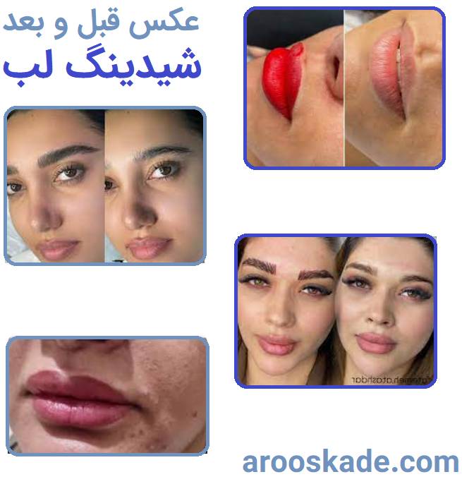 شیدینگ لب 