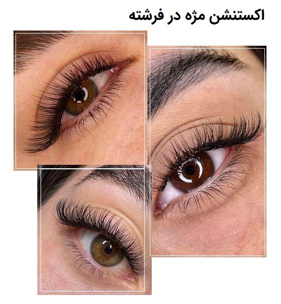 ترندهای کاشت مژه ۲۰۲۵ در شمال تهران