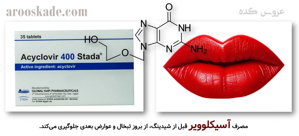شیدینگ لب در شمال تهران