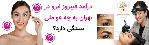 درآمد فیبروز ابرو در تهران به چه عواملی بستگی دارد؟