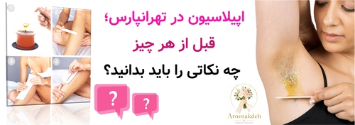 اپیلاسیون در تهرانپارس؛ قبل از هر چیز چه نکاتی را باید بدانید؟