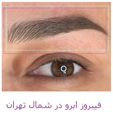 فیبروز ابرو شمال تهران