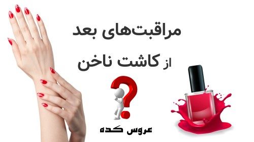 مراقبت‌های بعد از کاشت ناخن