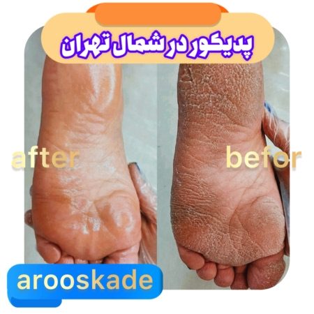 پدیکور شمال تهران