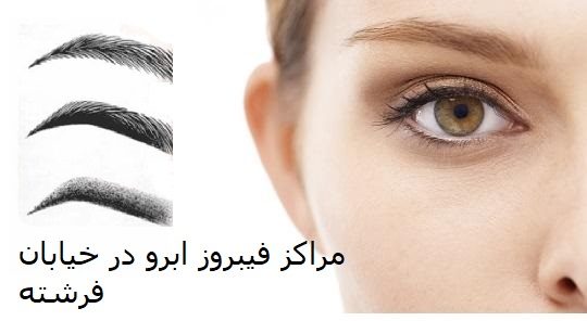 مراکز فیبروز ابرو در خیابان فرشته تهران