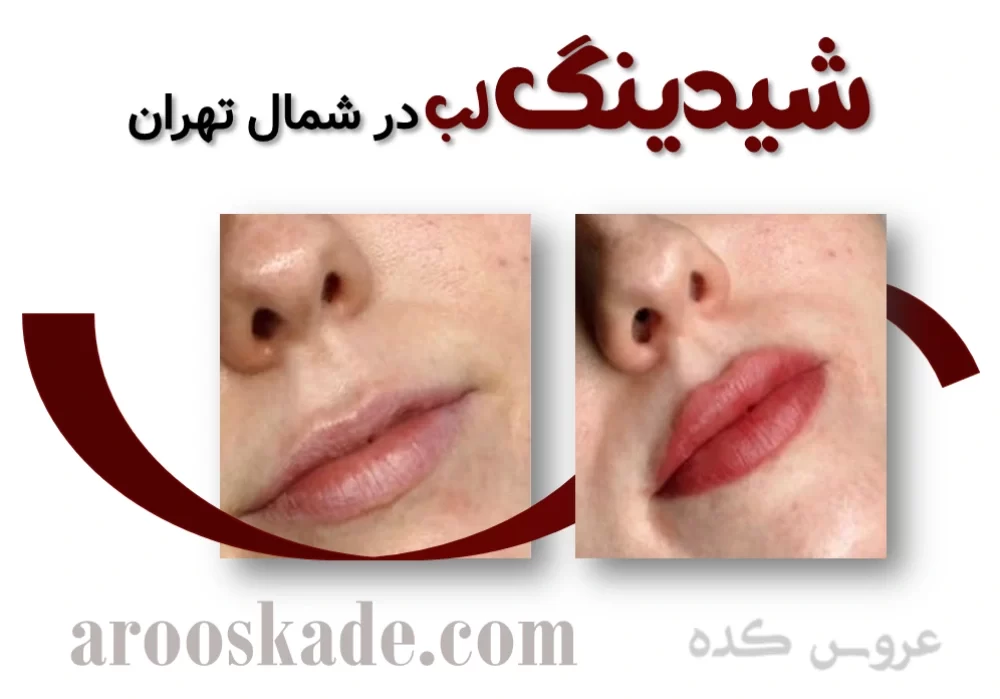 شیدینگ لب در شمال تهران